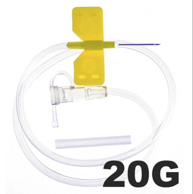 Изображение товара СФМ катетер д/малых вен игла-бабочка 20G (0,90х19мм) Изображение товара СФМ катетер д/малых вен игла-бабочка 20G (0,90х19мм)
